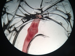Lemanea