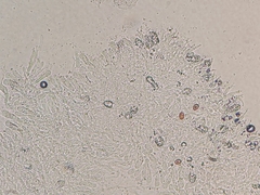 Hohenbuehelia cyphelliformis