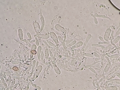 Hohenbuehelia cyphelliformis