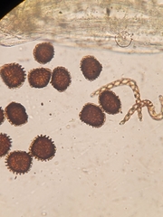 Fossombronia wondraczekii