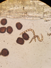Fossombronia wondraczekii