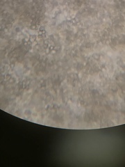 Saccharomyces cerevisiae