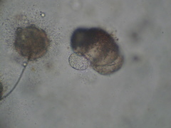 Chytridiomycota