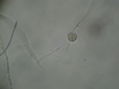 Pythium