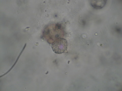 Chytridiomycota