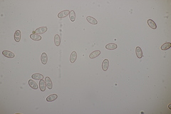 Sowerbyella radiculata