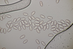 Sowerbyella radiculata