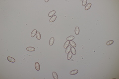 Sowerbyella radiculata