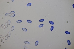 Sowerbyella radiculata