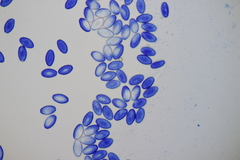 Sowerbyella radiculata