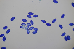 Sowerbyella radiculata