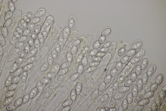 Sowerbyella radiculata