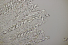 Sowerbyella radiculata