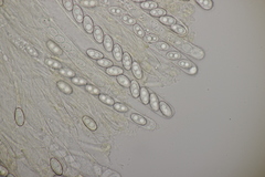 Sowerbyella radiculata