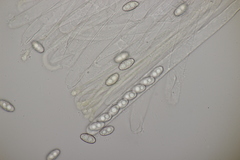 Sowerbyella radiculata