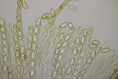 Sowerbyella radiculata