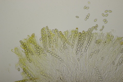 Sowerbyella radiculata