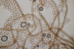 Arcyria stipata