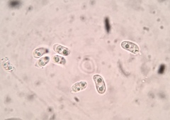 Hohenbuehelia grisea