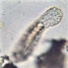 Chaetonotus