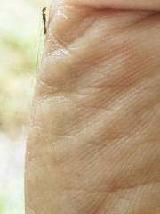 Pseudomyrmex oculatus