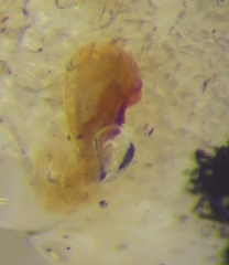 Coriomeris denticulatus