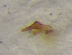 Cymus melanocephalus