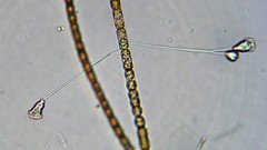 Pseudocarchesium