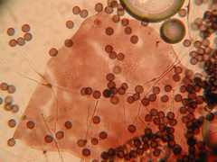 Didymium melanospermum