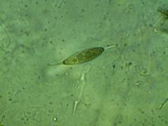 Rosellinia thelena