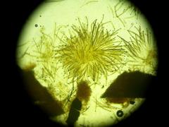 Rosellinia thelena