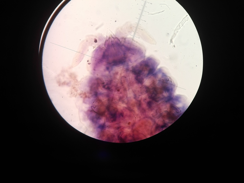 Arlesia