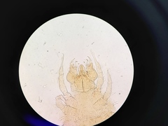 Cheyletidae