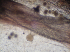 Chytridiomycota