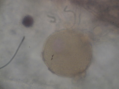 Chytridiomycota