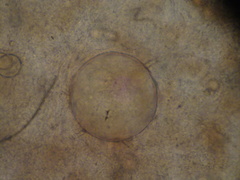 Chytridiomycota