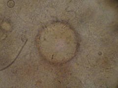 Chytridiomycota