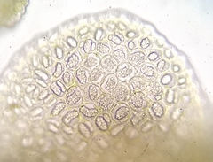 Cheilolejeunea clypeata