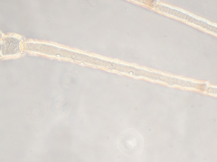 Hyperomyzus lactucae