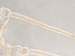 Hyperomyzus lactucae