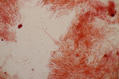 Phlebiodontia subochracea