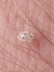 Corythucha ciliata