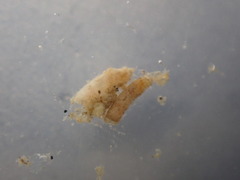 Caecum