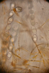 Neottiella