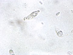 Dacrymyces corticioides