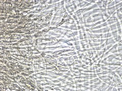 Dacrymyces corticioides