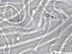 Dacrymyces corticioides