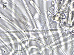 Dacrymyces corticioides