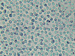 Steccherinum robustius