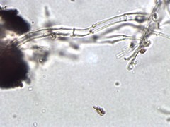 Elaphomyces verruculosus